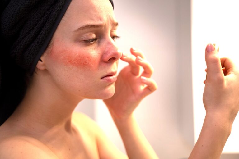 The Ultimate Winter Skincare Routine for Sensitive Skin